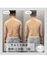 カラー(CALLA)/一回でも効果実感◎