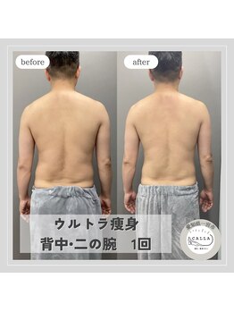 カラー(CALLA)/一回でも効果実感◎