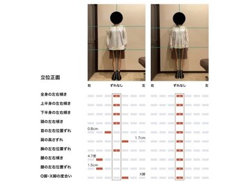 よくする CoCoLo新潟/お客様ビフォーアフター