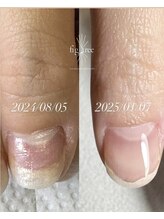 フィグ ツリー(fig tree)/地爪育成