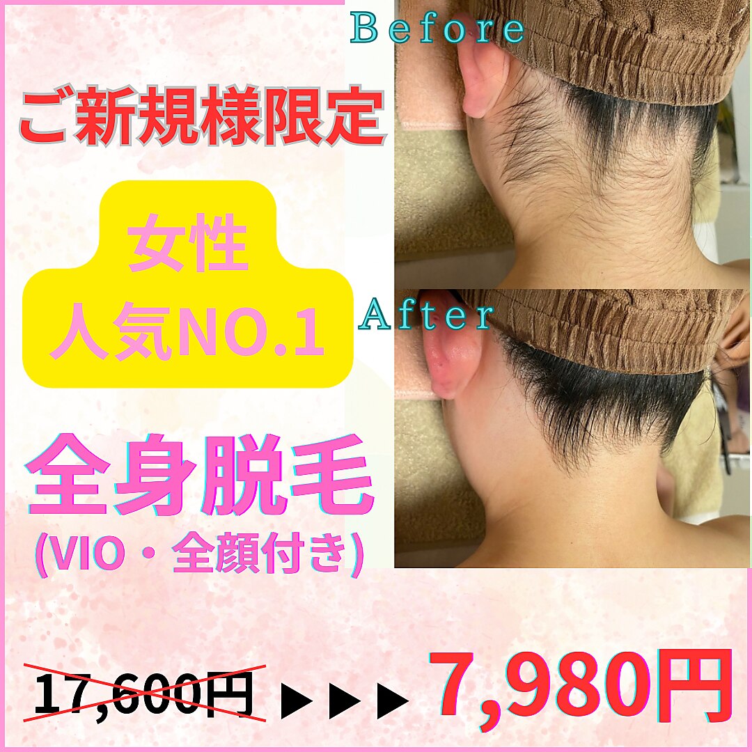 ソラ(SORA)｜ホットペッパービューティー