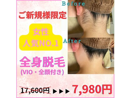 ソラ(SORA)の写真