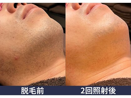 メンズアルファの写真
