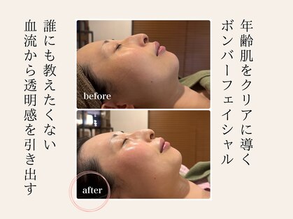 セルベッラ(cerbella)の写真