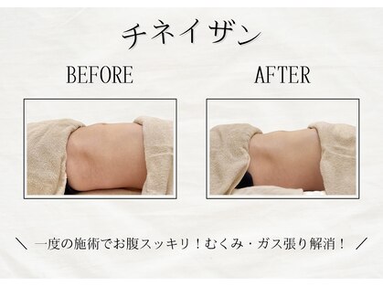 ルアーナエクリュ(Luana ecru)の写真