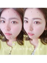 アイル(I’LL)/眉ワックス&パリジェンヌ