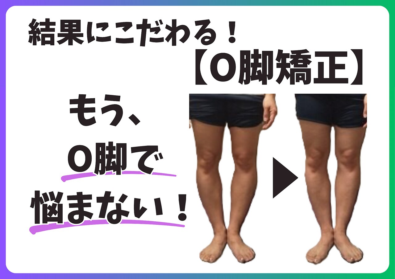 東京都でおすすめのO脚矯正｜ホットペッパービューティー