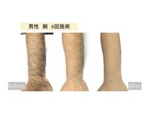 チェリーブロッサム 上福岡店(CHERRY BLOSSOM)/