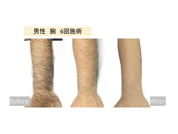 チェリーブロッサム 上福岡店(CHERRY BLOSSOM)/