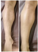 エン(en.)/BeforeAfter写真28