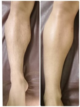 エン(en.)/BeforeAfter写真28