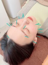 ヒーリングサロン アージュ(A-je)/★美顔鍼＋小顔矯正★