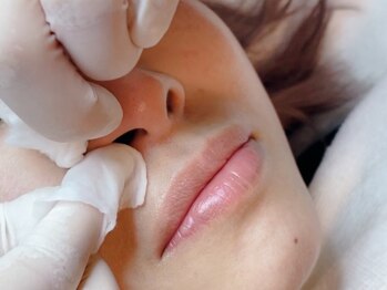 プレッシュ(Presh)/毛穴エクストラクション