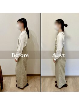 メイリリー(may lily)/◇施術イメージ　20代女性◇