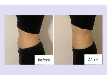 ミヌレ 京都店(minulle)/下腹ぽっこり解消