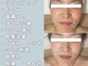 【西日本初取扱店】LDMリフティング/首デコルテケア付+幹細胞培養液+光フォト