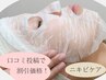 【ニキビケア/赤ら肌】Google口コミ投稿で割引価格！