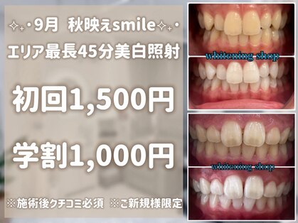 ホワイトニングショップ 川越店の写真