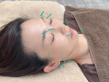 ユーフォリア(Euphoria)の写真/鍼灸が施す体質ケア☆首肩こり・腰痛など不調箇所を中心に、お悩みに合わせて全身へアプローチを行います♪