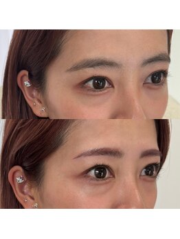 ロウ(LEAU)/before after