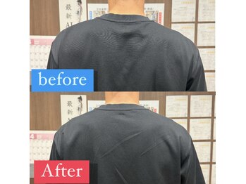 ナオル整体 宮崎院(NAORU整体)/20代男性施術事例【姿勢改善】