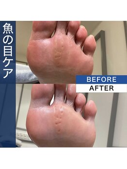 ペディケア 横浜本店/