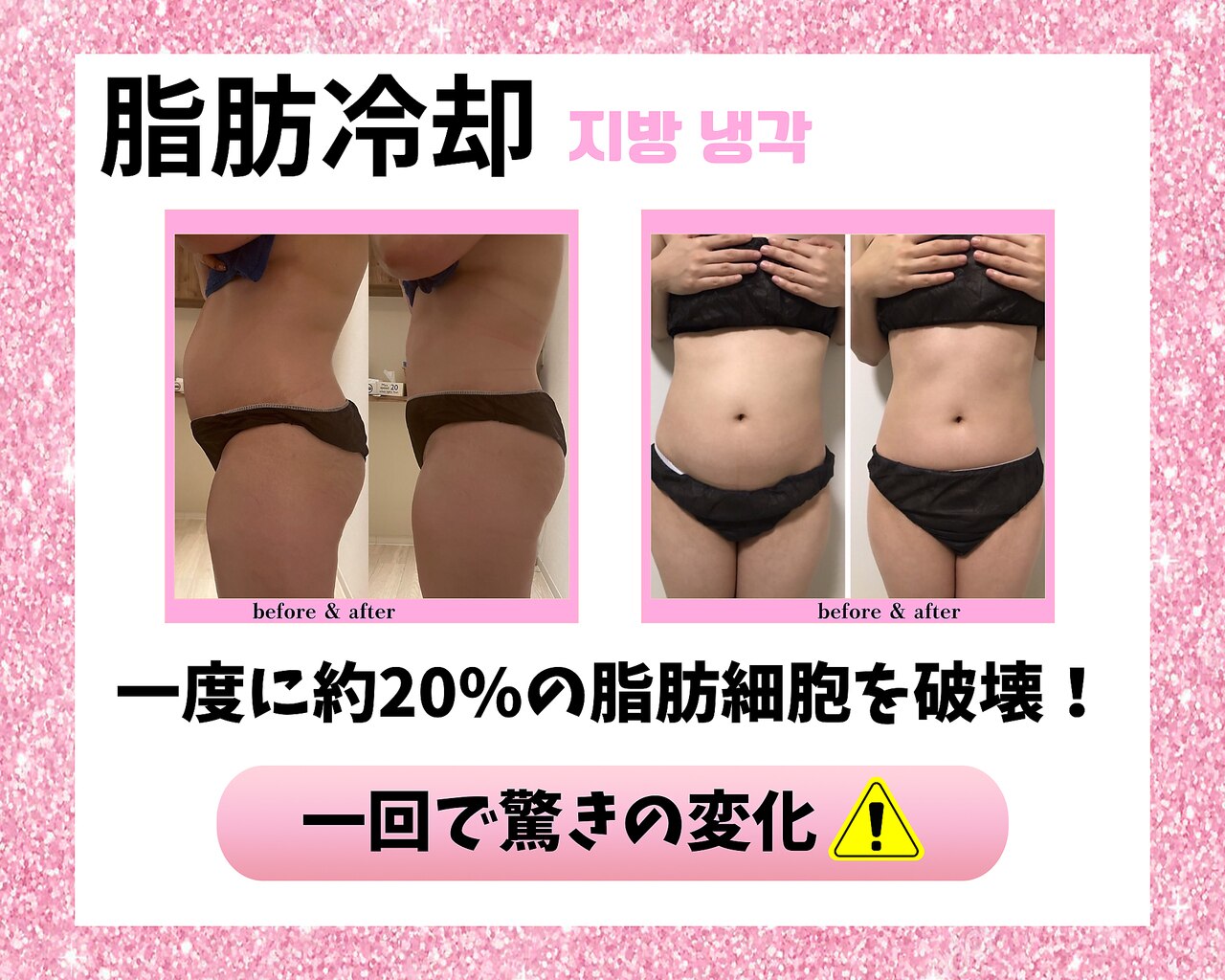 リファインPRO SP■アミン総合エステ美容器■美肌・痩身・ 脂肪分解 吸引③ Yahoo!オークション - 「アミン リファイン」家電、AV、カメラの落札