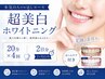 【本気の人のお試しコース】超美白ホワイトニング2日分+ホームケア付¥12,000
