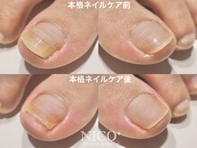 ニコプラス(NICO+)/爪育ネイルケア