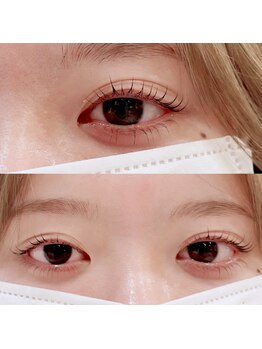 メリス(Mellis)/上下ラッシュリフト