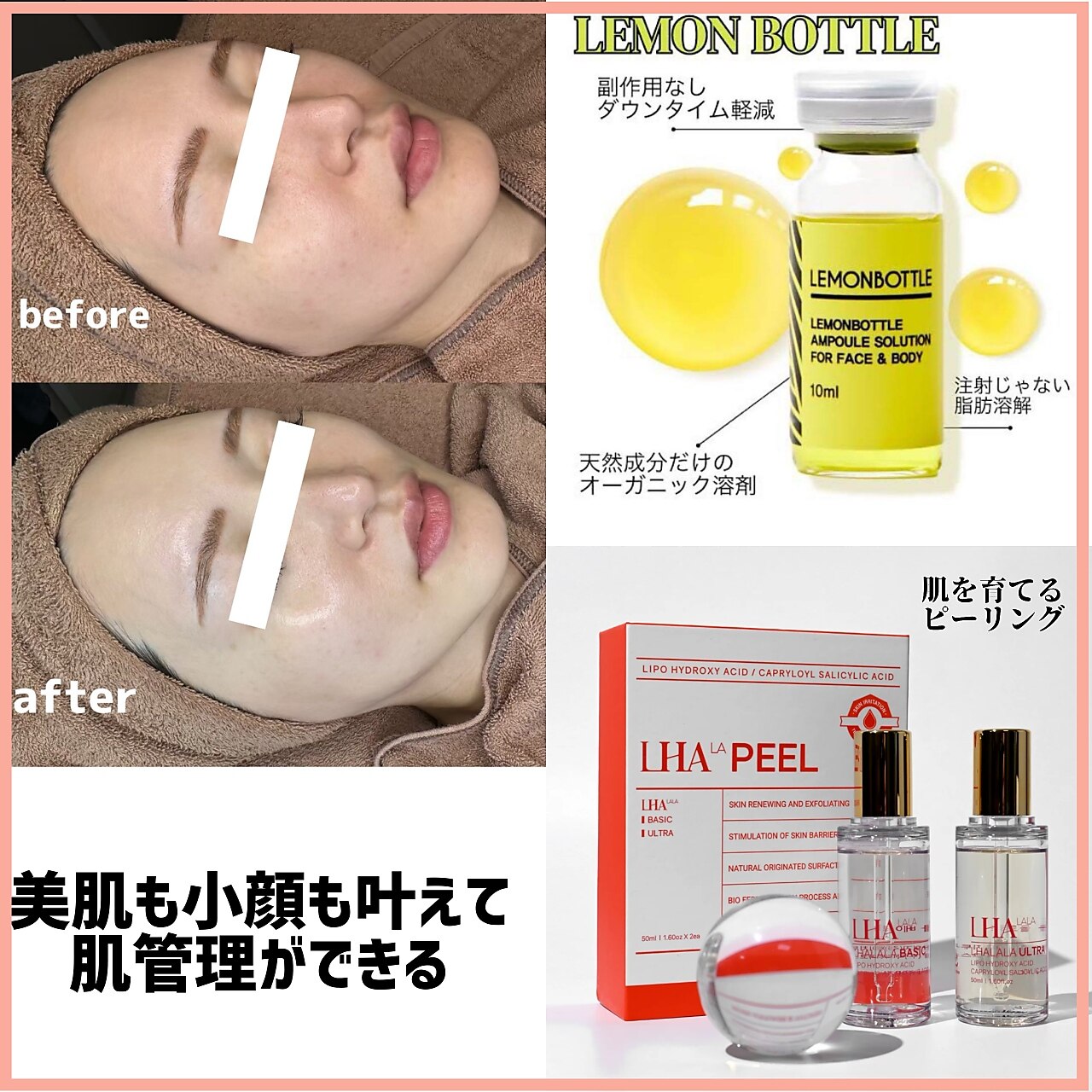 輝く高品質な LEMONBOTTLE 「脂肪溶解注射用 （ノアグロウフェイシャル 溶剤」 ブースター・導入液