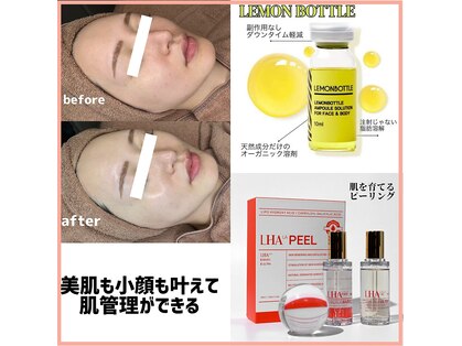 レアビューティー(Le'a beauty)の写真