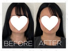 コノハナ(conohana)/フェイスラインがすっきり！