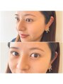 メイクアップラニ(MAKE UP LANI) どの角度から見ても可愛い!