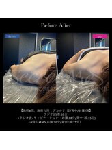 グラシアス/グラシアス | 症例写真