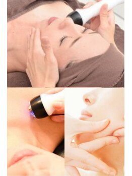 ゼクサースポーツスタジオ(ZEXER SPORTS STUDIO)の写真/<年齢による"ほうれい線・たるみ・皮膚余り"改善!>コラーゲン大量生成【ハイパーナイフ】でハリ×弾力UP♪