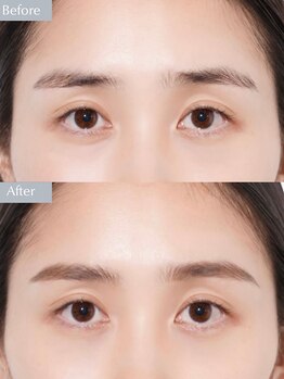 ビエル(BIeL)の写真/【話題沸騰】眉癖改善ナチュラル美眉★自然なのに洗練された眉に。印象が変わるHBL&WAX脱毛♪