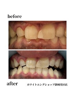 ホワイトニングショップ 葵区静岡駅店/ホワイトニング店ホワイトニング