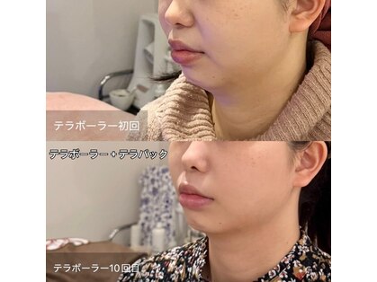 TCM-y...の写真