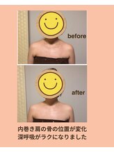 イーズリー(easily)/BEFORE→AFTER