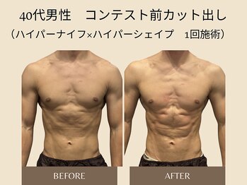 オベリオ(OBERIO)/コンテスト選手用カット出し施術