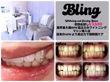 ブリング(Bling)