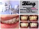 ブリング(Bling)の写真