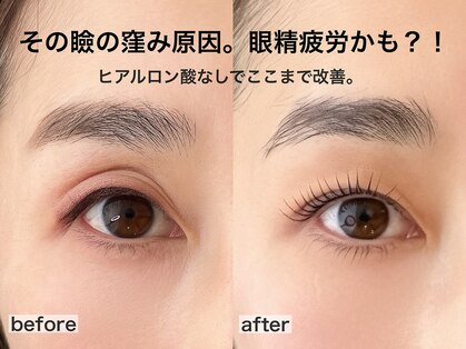 rutileの写真