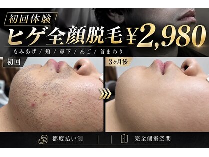 ジェントル 福岡天神店(GENTLE)の写真