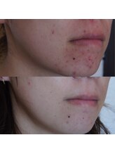 トラット エステアンドアイズ(tratto)/30代　お客様症例写真