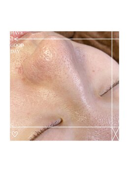 アクトウーマン(AKTWOMEN)/小鼻ワックスと肌補修シートで！