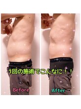 ルミネ(Lumine)/男性のポッコリお腹諦めないで！