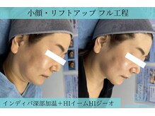 リメイククリニカルビューティー(Remake clinical beauty)/もたつき解消