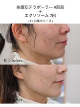 アオダモ(aodamo)/